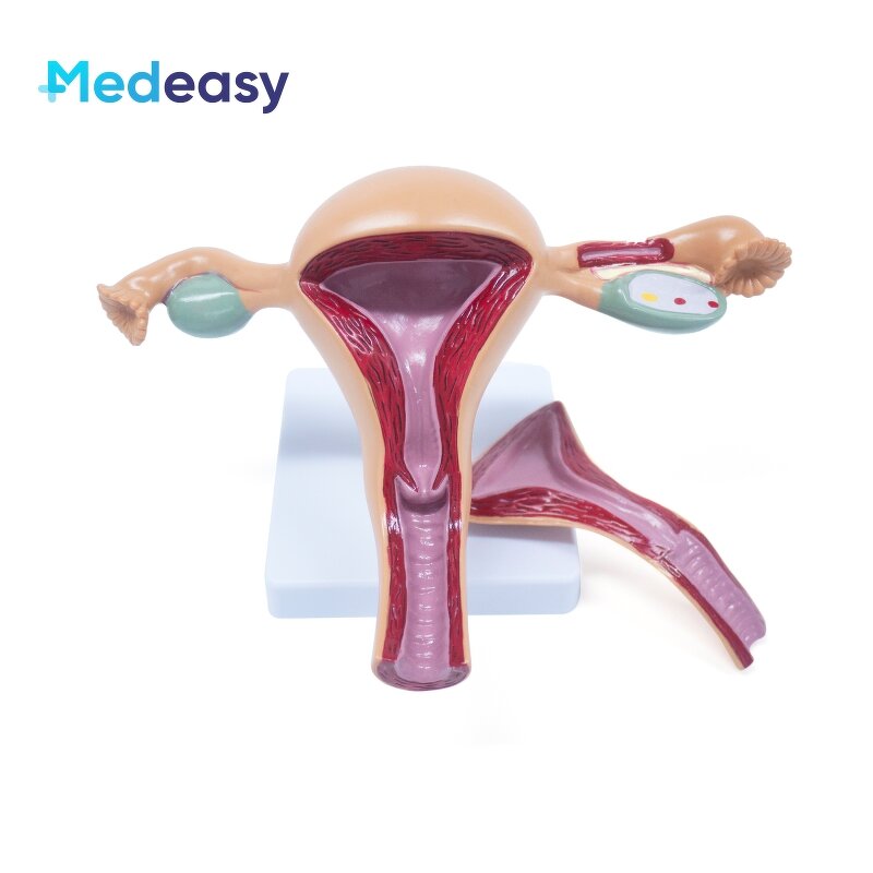 Female Uterus Anatomical Model Manufacturer - Vagina Model Plastic Uterus Normal