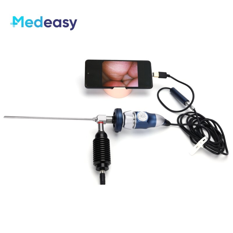 Medical Portable Endoscope Camera Factory - Multi-Display USB HDMI HD 1080P