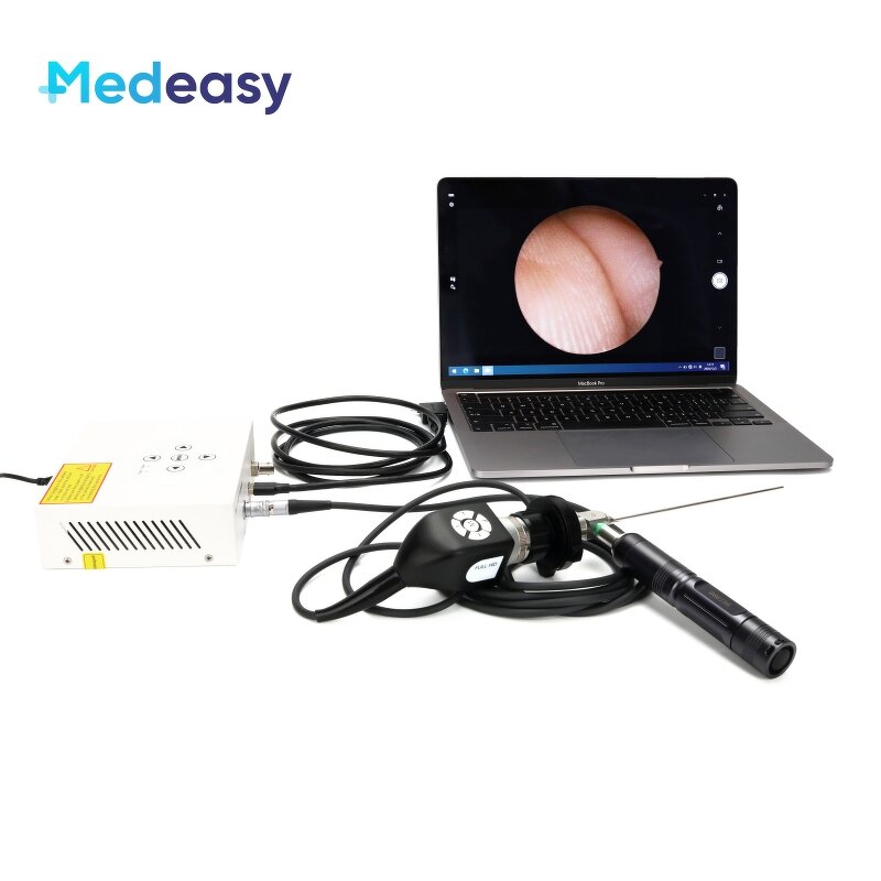 Multi-output Endoscope Camera Manufacturer - Medical Full HD 1080P USB