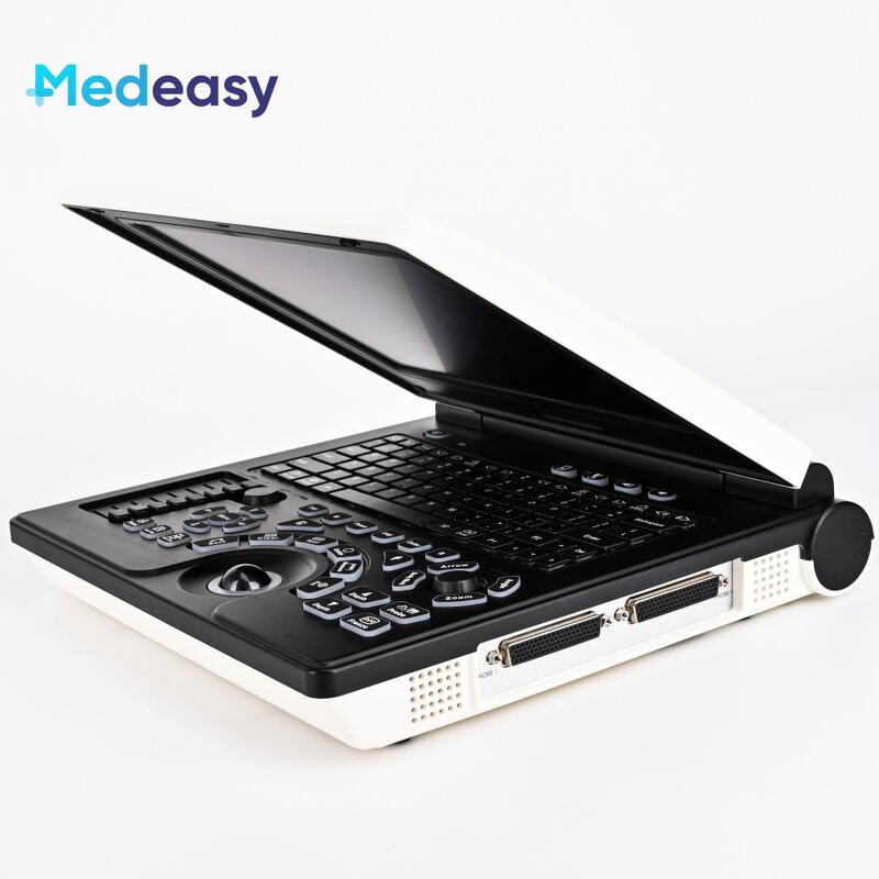 Portable Ultrasound Supplier - New Type Laptop Doppler Test Diagnostic
