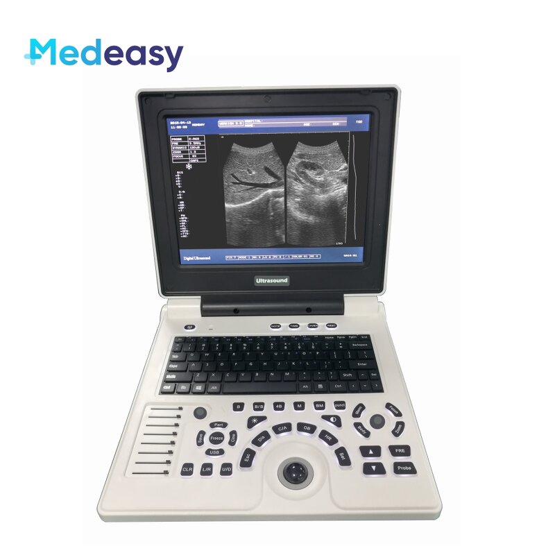 Portable Wireless Ultrasound Manufacturer - Hot Selling Mini 2 in 1 Custom