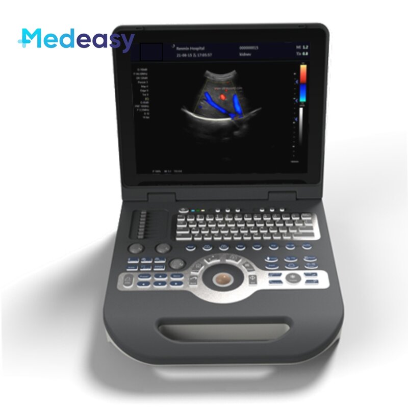 Color Doppler Ultrasound Scanner Supplier - Mindray 4d Portable Attractive Price