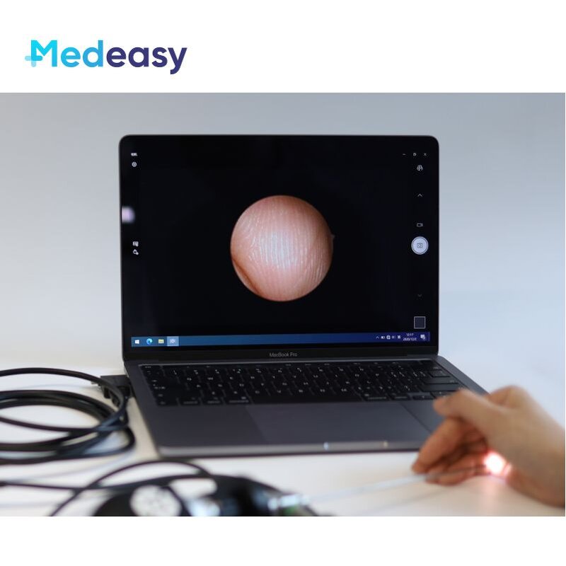 Medical Endoscope HD USB Camera Factory - 1080P for Surgery Endoscopic