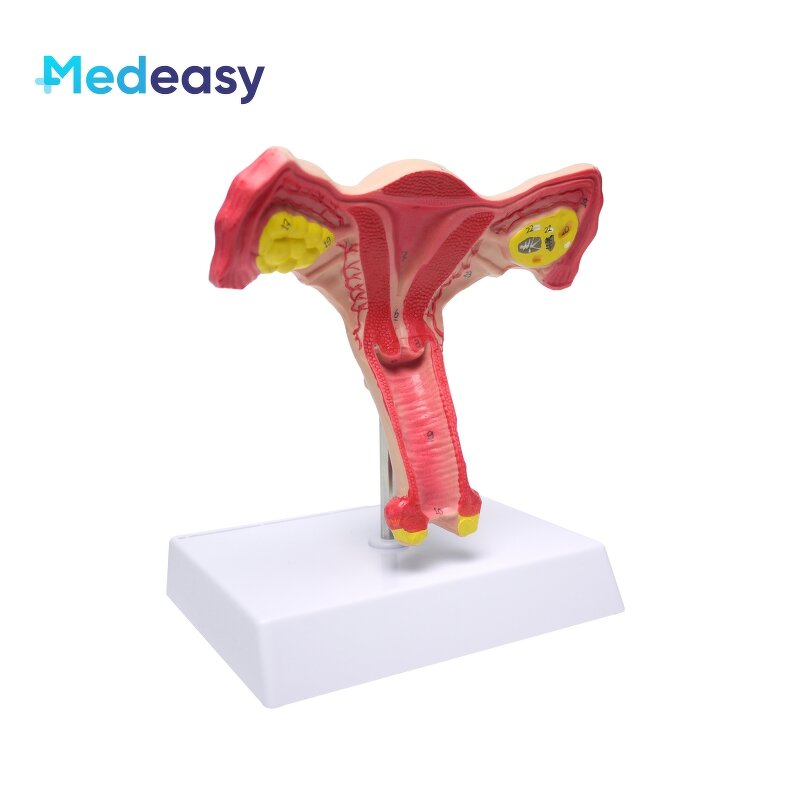 Female Uterus Anatomical Model Manufacturer - Vagina Model Plastic Uterus Normal
