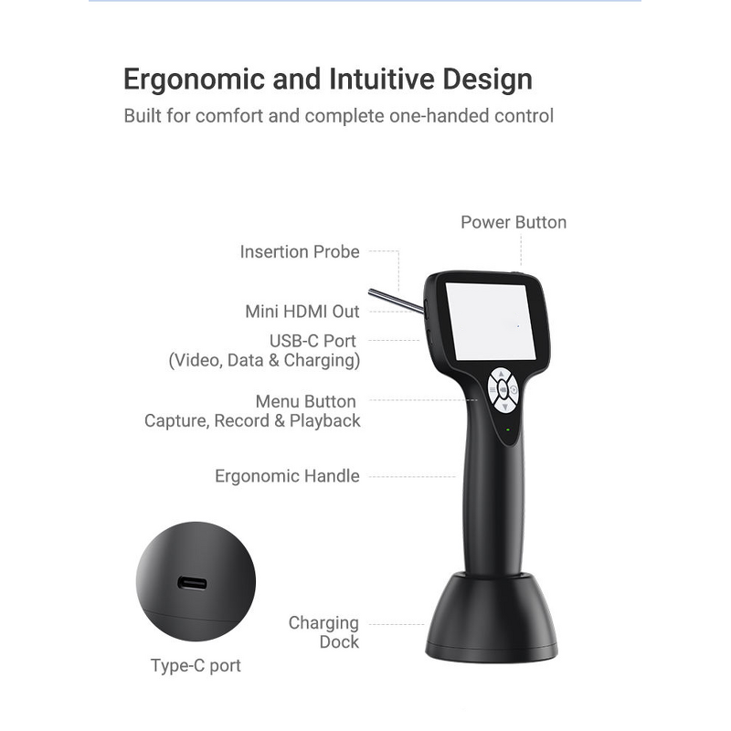 Portable Ent Endoscope Video Otoscope Manufacturer - Digital Visual Ear Camera