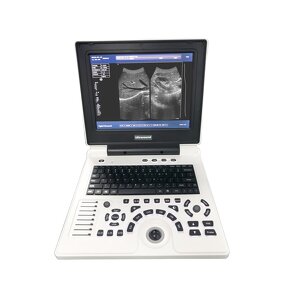 Portable B Ultrasound Scanner Supplier - 12 Inch LED Laptop Full Digital