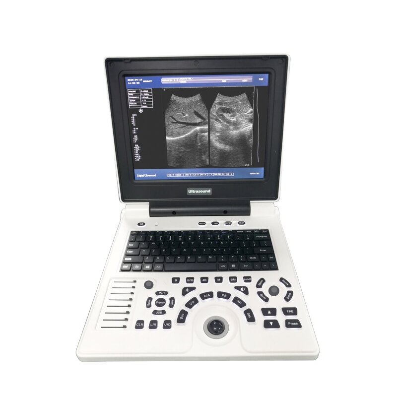 Portable B Ultrasound Scanner Supplier - 12 Inch LED Laptop Full Digital