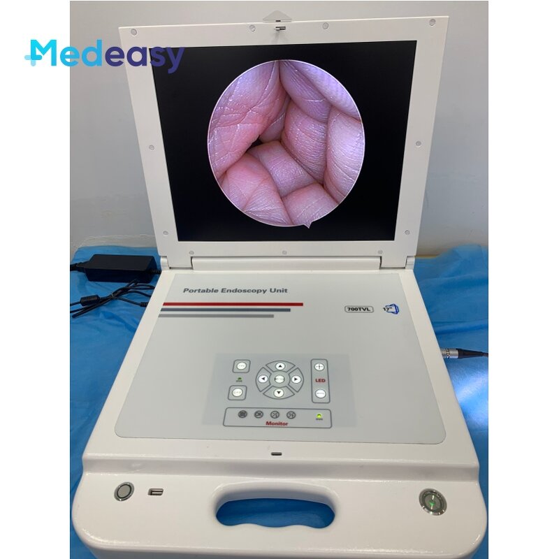Medical Endoscope Camera System Supplier - With Led Light Monitor Recorder