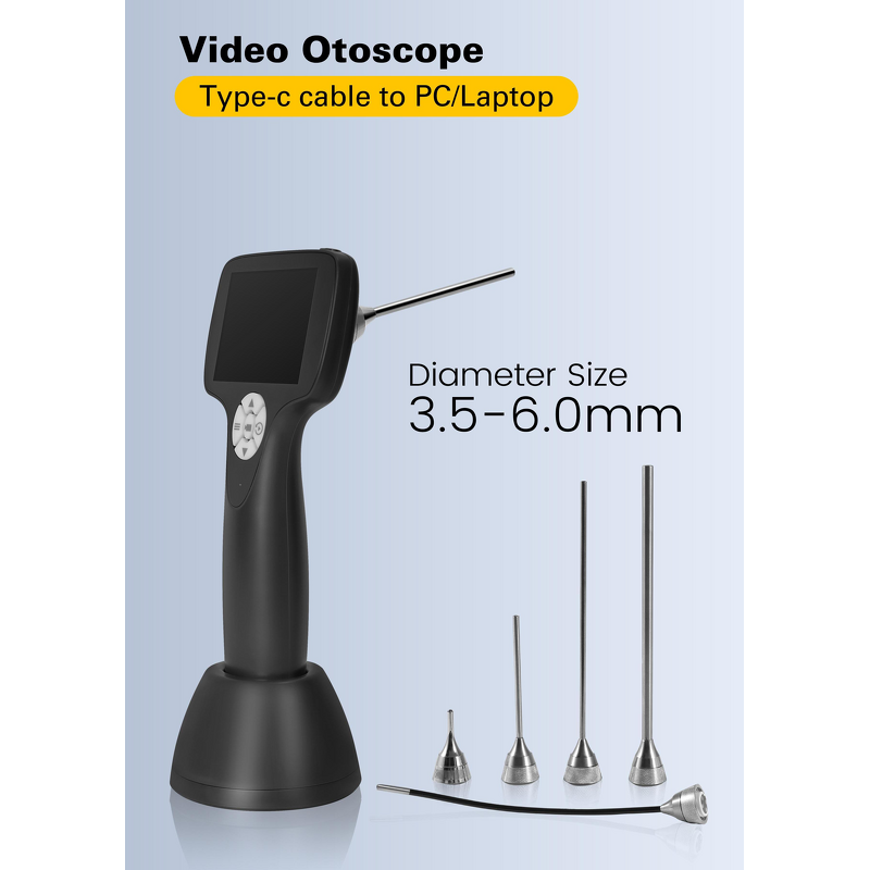 Portable Ent Endoscope Video Otoscope Manufacturer - Digital Visual Ear Camera