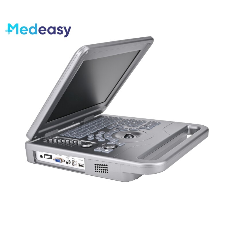 Black White Ultrasound Machine Supplier - 12inch Laptop with Convex Probe