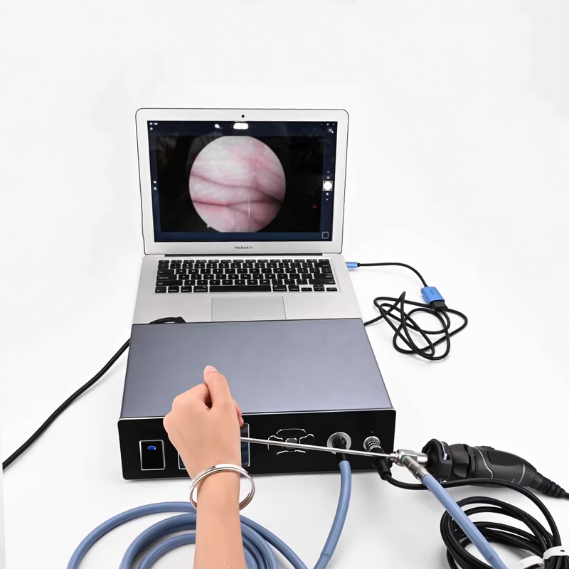 Medical Endoscopy Camera System Supplier - 1080P 60FPS Full HD with Light Source