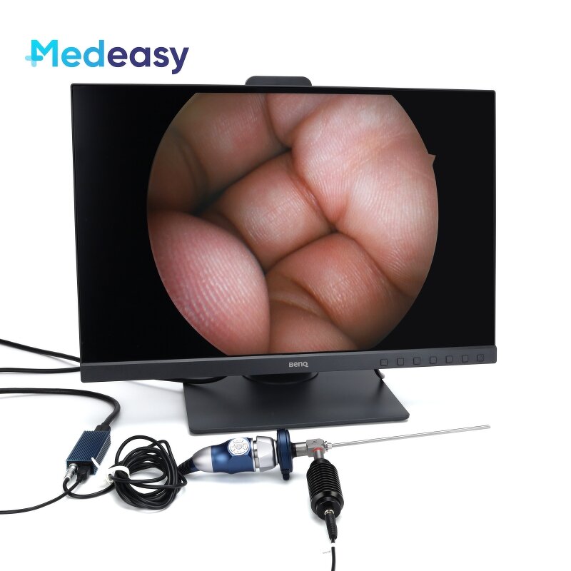 Medical Portable Endoscope Camera Factory - Multi-Display USB HDMI HD 1080P