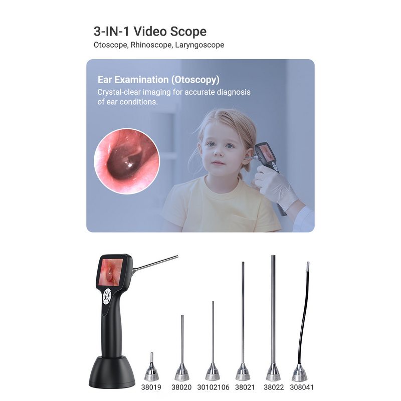 Portable Ent Endoscope Video Otoscope Manufacturer - Digital Visual Ear Camera
