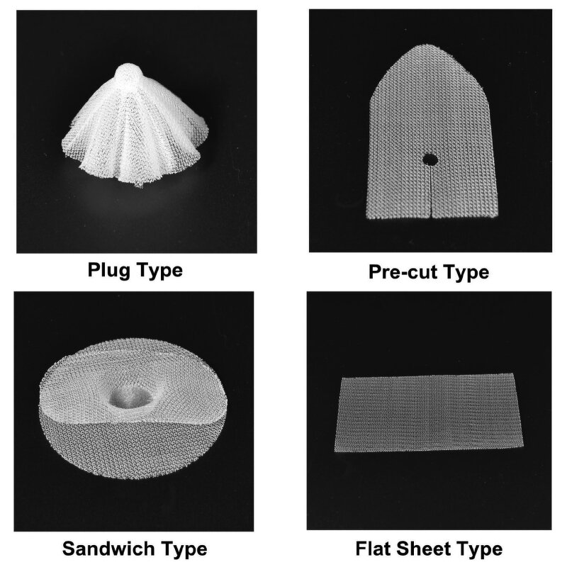 Surgical Hernia Repair Mesh Supplier - Medical Repair Mesh for Hernia
