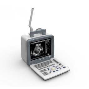 Pocket Portable Ultrasound Manufacturer - Special Design Full Digital LED