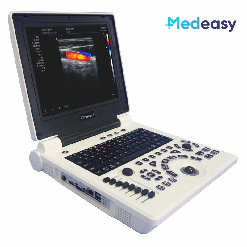 Laptop Ultrasound Scanner Factory - New B/W Device Portable with PW/ IMT