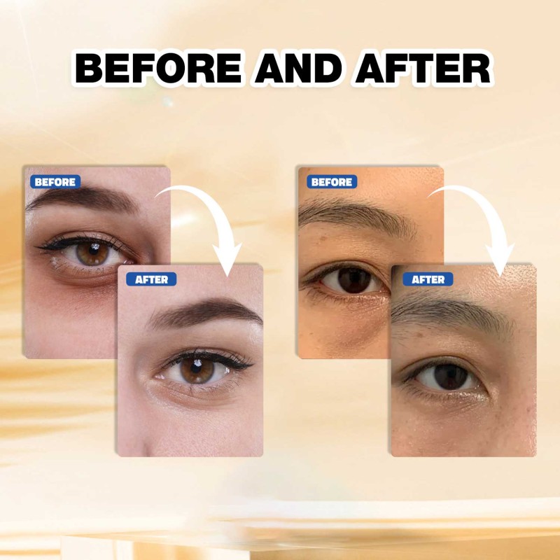 Private Label Gold Gel Mask 24 Pieces Soothing Hydrating Under Eye Patches for Dark Circles