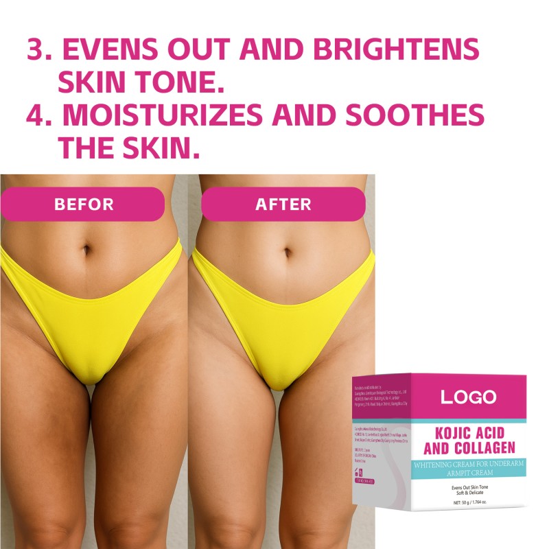 Custom logo 50G Women Underarm Whitening Collagen Kojic Acid Armpit Cream