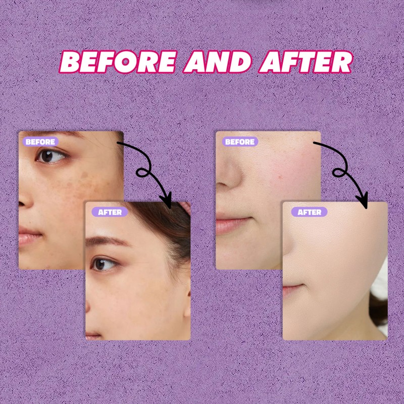 OEM 50ML Skin Care Products Brighten Skin Tone Improve Dark Spot Remover for Face Body