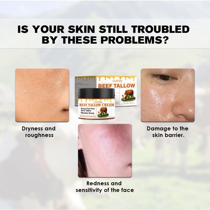 Factory OEM Beef Tallow Cream Skin Care Cream 100% Tallow Balm Natural Moisturizing Tallow Face Cream