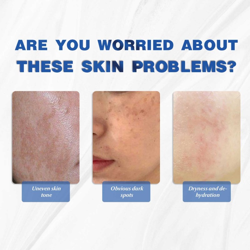 OEM ODM Cosmetic Face Lightens Dark Spot Removing Essence for Dull Dark Skin