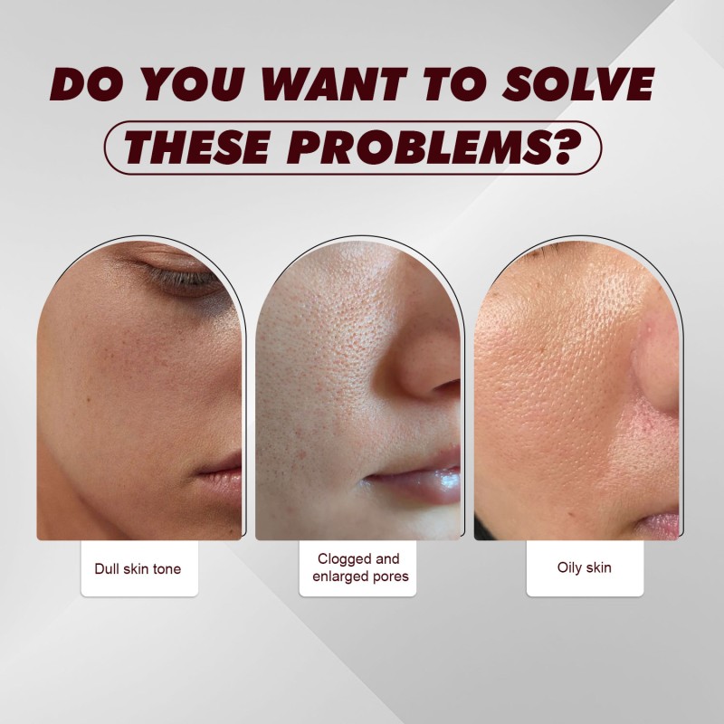 30ml Salicylic Acid Brightening Face Serum Hydrating Control Oil 12% AHA BHA PHA LHA Peeling Solution