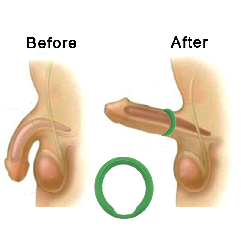 Health Enlargement Penis Ring Manufacturer - Silicone Sex Power Cock Rings Quantum