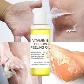 Factory Private Label Yellow Peeling Oil Vitamin C Knuckle Whitening Moisturizing Dark Spot Removal Extra Strength Peeling Oil
