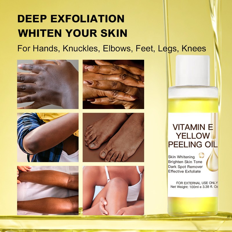 Factory Private Label Yellow Peeling Oil Vitamin C Knuckle Whitening Moisturizing Dark Spot Removal Extra Strength Peeling Oil
