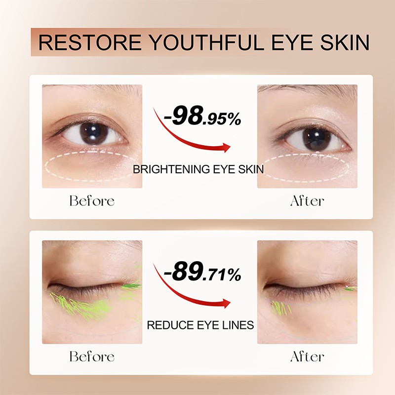 Private Label Skin Care Product Dark Circles Eye Bags Removal Cream Caffeine Anti-Aging Firming 15g Brightening Eye Cream
