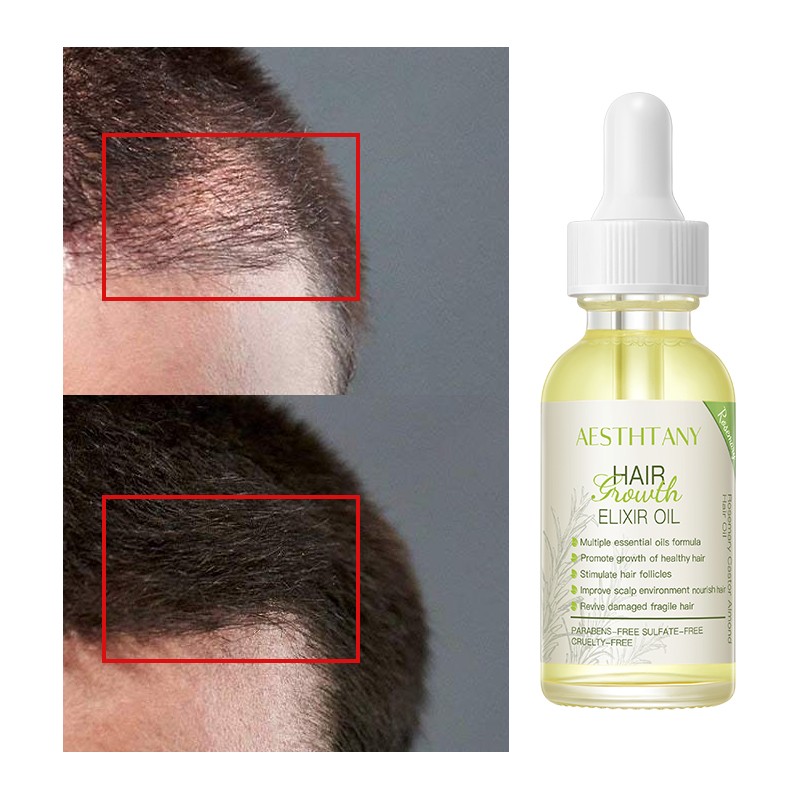 7 Days Hair Growth Natural Rosemary Essential Hair Growth Oil for Hair Regrowth