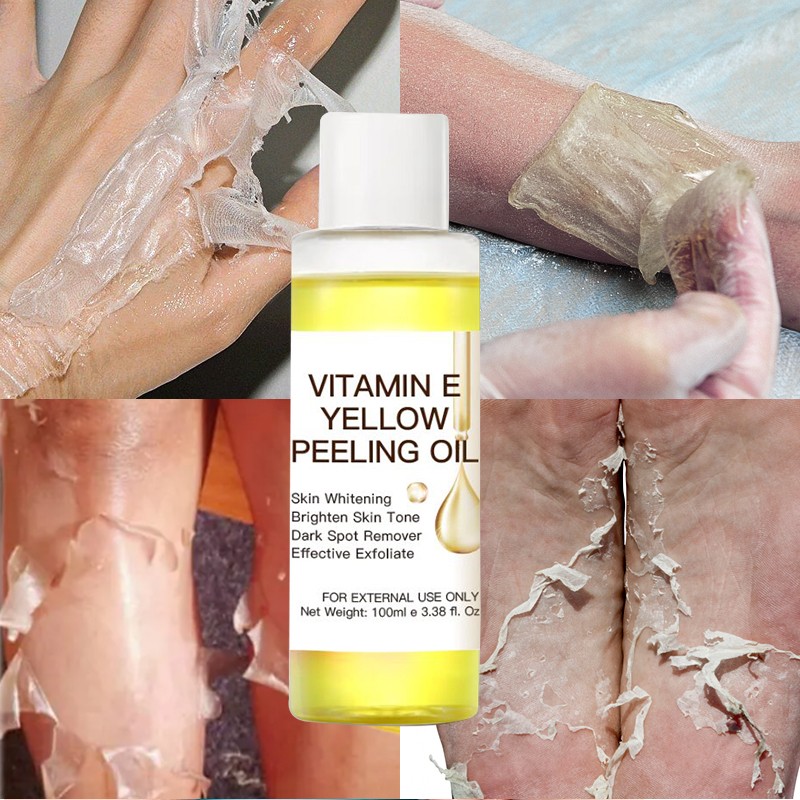 OEM ODM Organic Black Skin Lightening Oil,Yellow Orange Skin Bleaching Body Oil,Factory Wholesale Whitening Peeling Oil