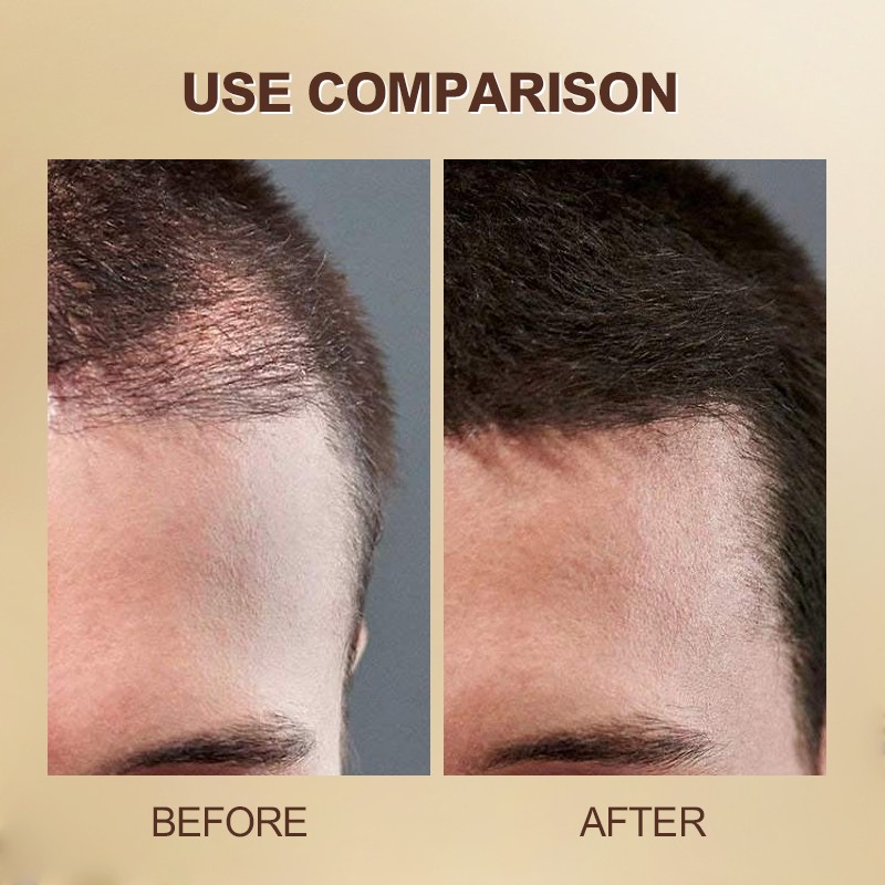 7 Days Hair Growth Natural Rosemary Essential Hair Growth Oil for Hair Regrowth