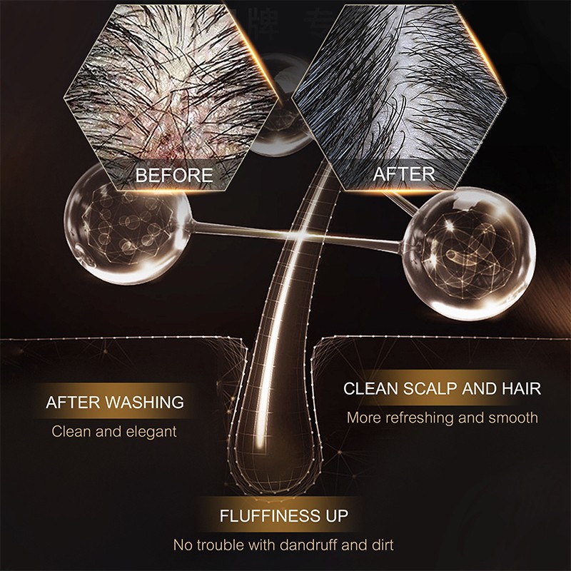 OKADY 500ml Ginger Arborvitae Leaf Brightening Oil-control Hair-Loss Prevention Hair-Repairing Shampoo