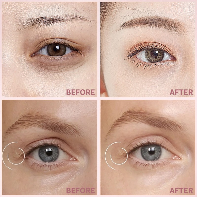 Brighten Revitalize Tired Eyes Caffeine Hyaluronic Acid Under Eye Patches Masks