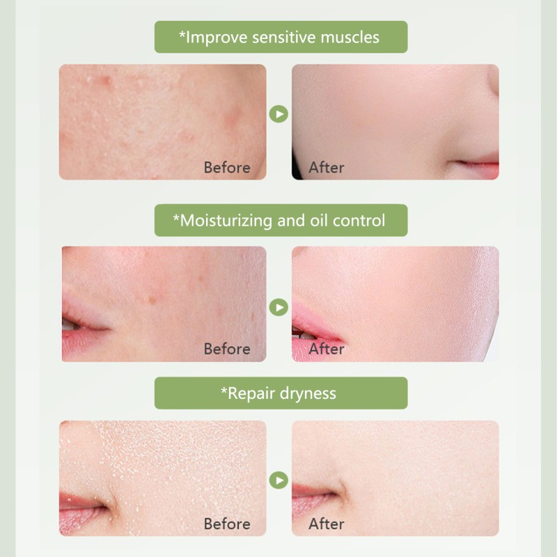 Soothing Moisturizing Repair Gel with 99 Percent Aloe Vera for Hydration Sunburn Relief and Skin Care Aloe Vera Gel