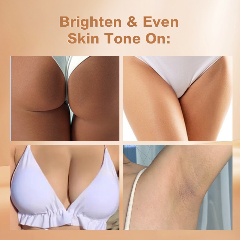 Female Body Private Part Whitening Cream Intensive Bleaching Breast Underarm Whitening Serum Cream for Sensitive Areas