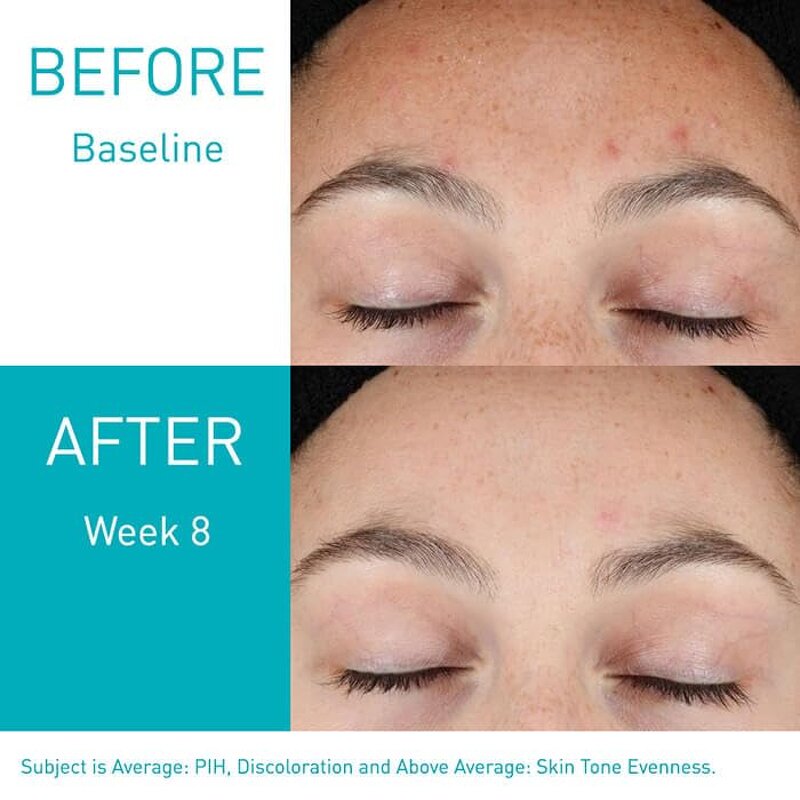 Hyaluronic Acid Serum Factory - Wholesale Cera Retinol Resurfacing 30ml