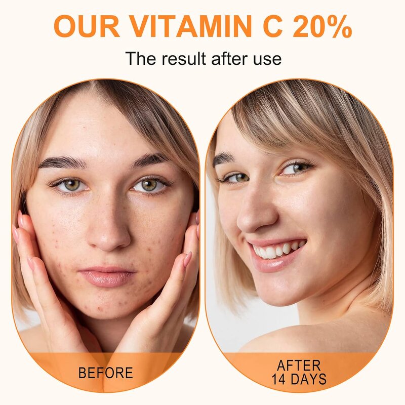 Vitamin C Serum Factory - Wholesale Brightening Anti-Aging Spot-Fading