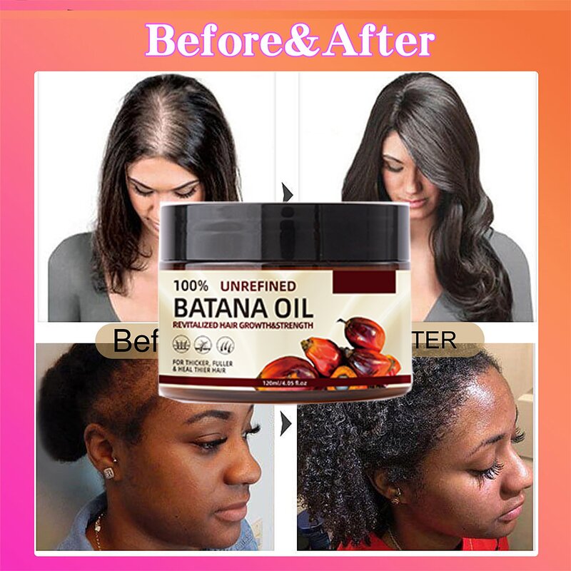 Batana Oil Factory - OEM/ODM Custom Organic Butter Hair Growth Treatment