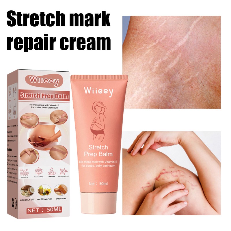 Anti Marks Scar Stretch Marks Removal Whitening Cream for Pregnancy Repair Stretch Marks Removal of Pregnancy Women