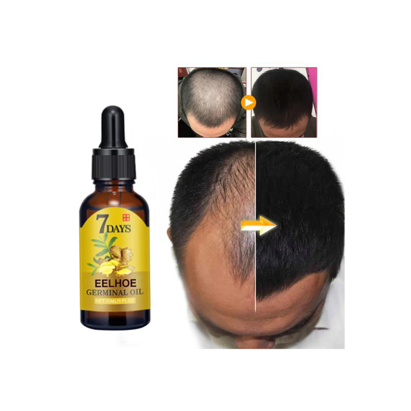 100% Natural Organic Anti Loss Hair Growth Damaged Hair Repair Ginger Extract Hair Growth Care Germinal Scalp Oil Serum