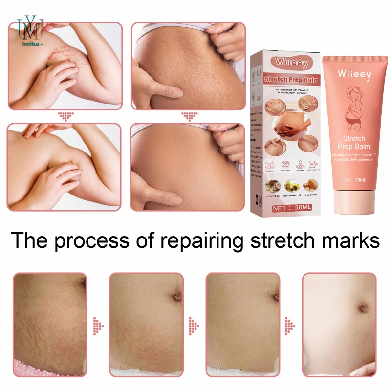 Natural Stretch Mark Repair Cream Effective Skin Repairing Gel Stretch Marks Scar Removing Cream
