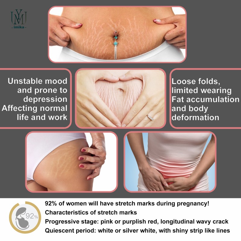 Natural Stretch Mark Repair Cream Effective Skin Repairing Gel Stretch Marks Scar Removing Cream