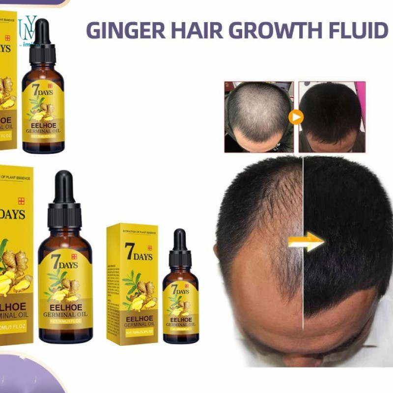Natural Hair Growth Essential Ginger Oil Effect Repair Scalp Damaged Hair Care for Thick Hair Fast Growth