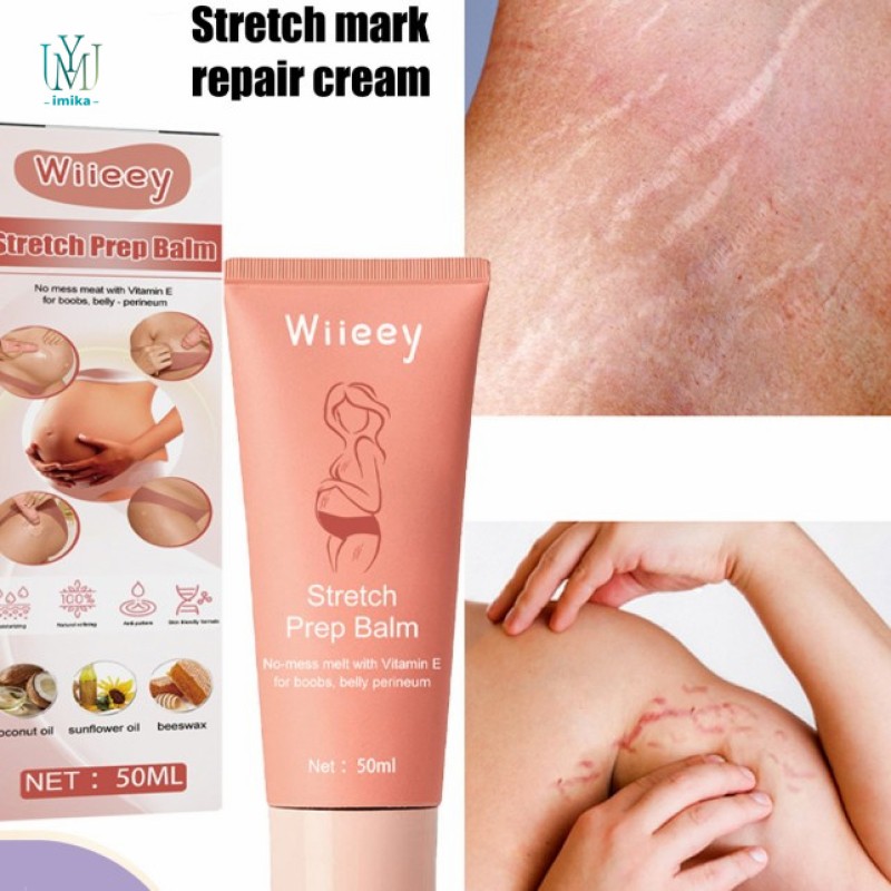 Anti Stretch Marks Cream Repair Skin Nourishing Pregnancy Stretch Removal Cream Scar Care Maternity Cream for Pregnancy