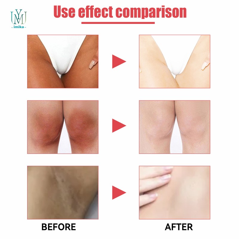 Deep Nourishment Private Parts Pink Tender Cream Intimate Pink Tender Skin Professional Skin Care Gel Cream for Charming Tender