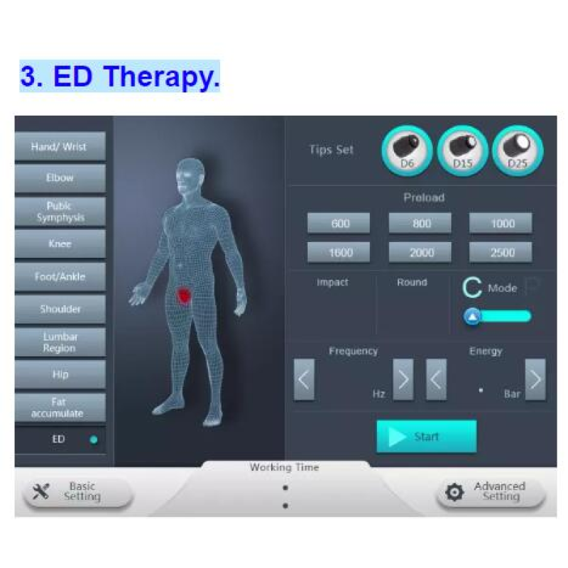 Hot Sale ShockWave Therapy for Erectile Dysfunction