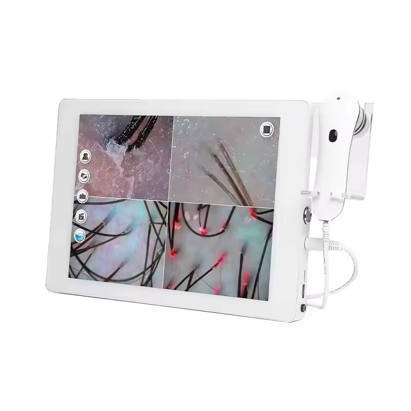 High Definition Skin Scalp Analyzer Facial Care Device Skin Scanner Hair Growth Follicle Detection Device