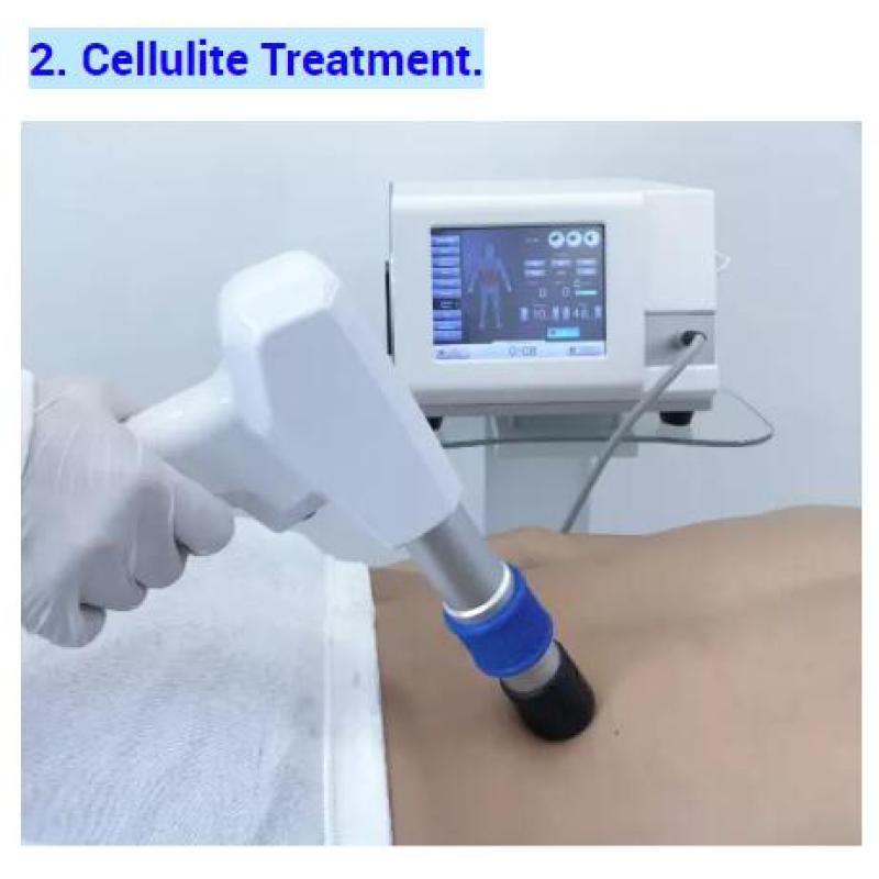 Hot Sale ShockWave Therapy for Erectile Dysfunction